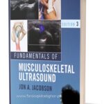 Fundamentals of Musculoskeletal Ultrasound