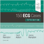 150 ECG Cases, 5th Edition