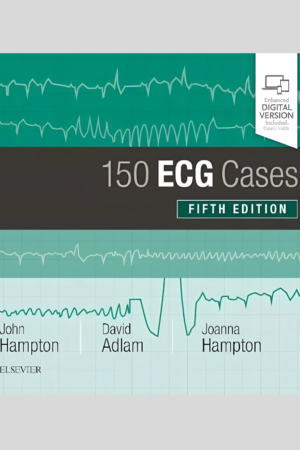 150 ECG Cases, 5th Edition