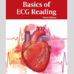 BASICS OF ECG READING 3ED Edition